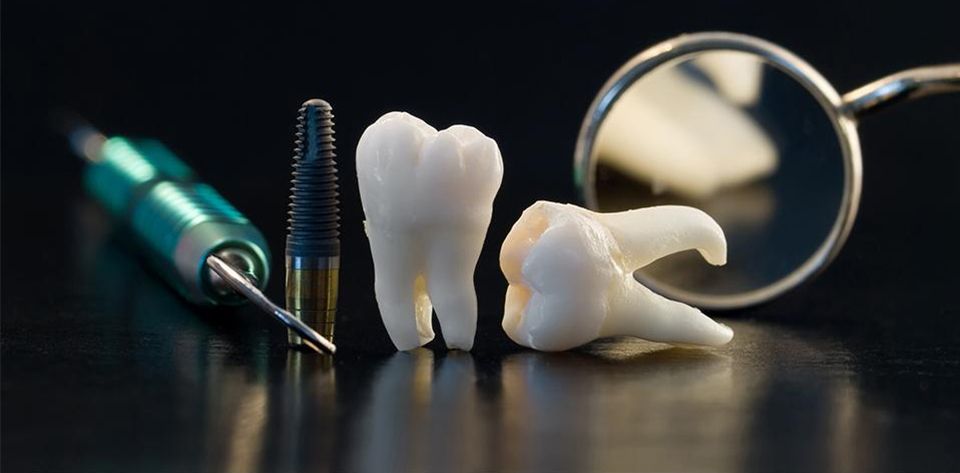 Clínica Dental Juriondo instrumentos odontologicos